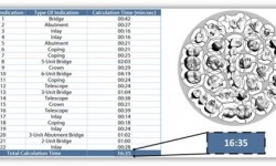 Dental (calculation times)