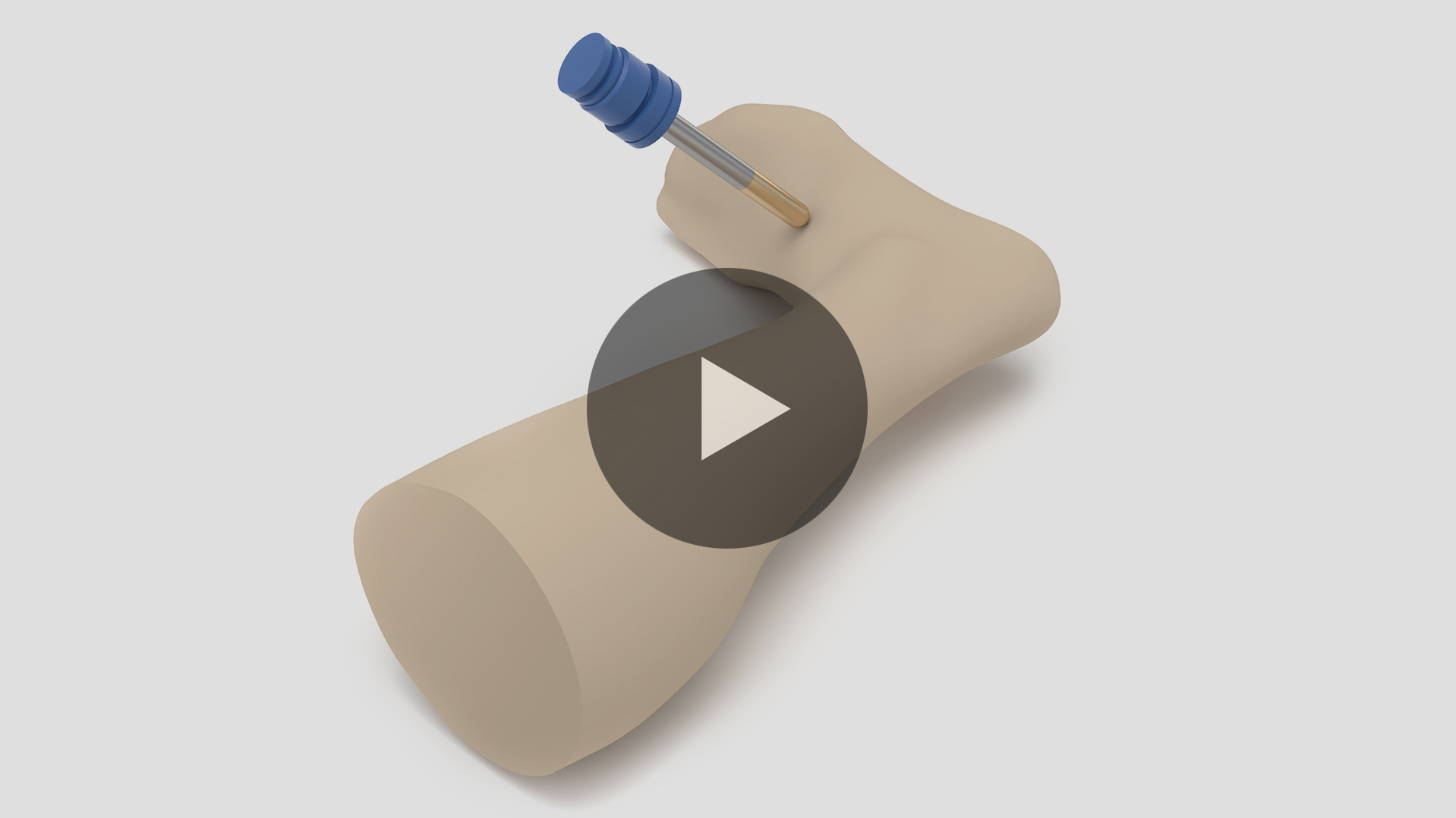 Orthopedic
